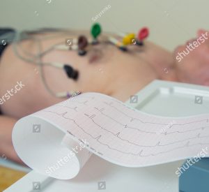 Elettrocardiogramma a Melegnano
