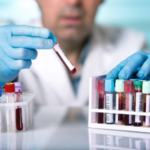 Analisi del sangue in San Giuliano Milanese
