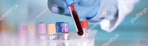 Analisi del sangue a Melegnano