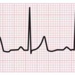 ELETTROCARDIOGRAMMI ADULTI e BAMBINI